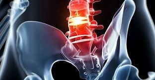 Scientific Specialist: Lumbar Herniated Discs And Sciatica