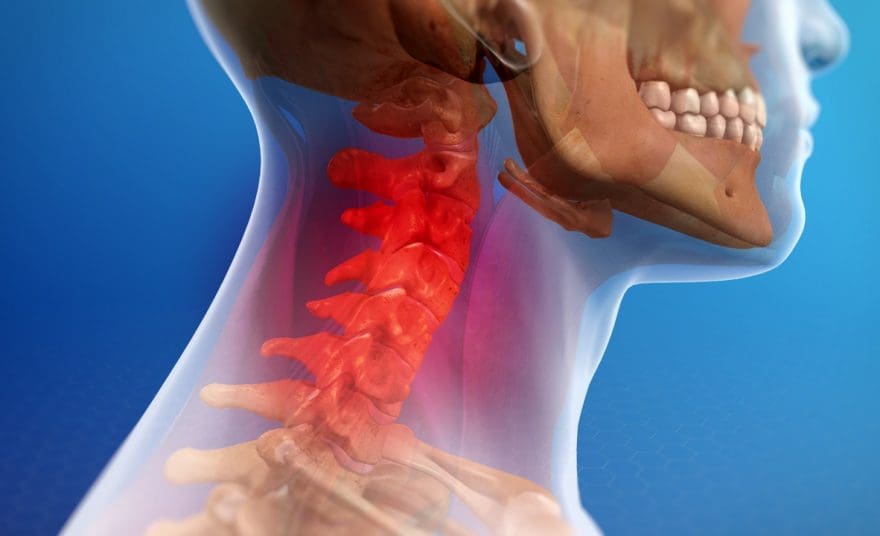 Understanding the Signs and Symptoms of Whiplash Injuries - El Paso Chiropractor