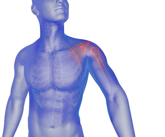 frozen shoulder syndrome chiropractic treatment, el paso tx.