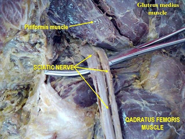 piriformis muscle gross anatomy el paso tx