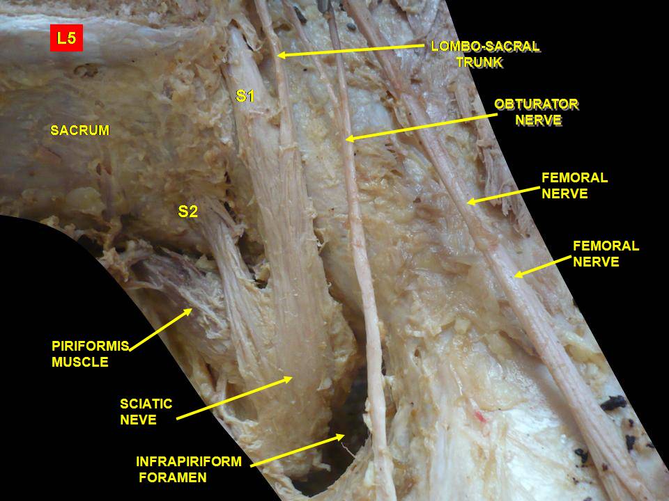 piriformis gross anatomy el paso tx