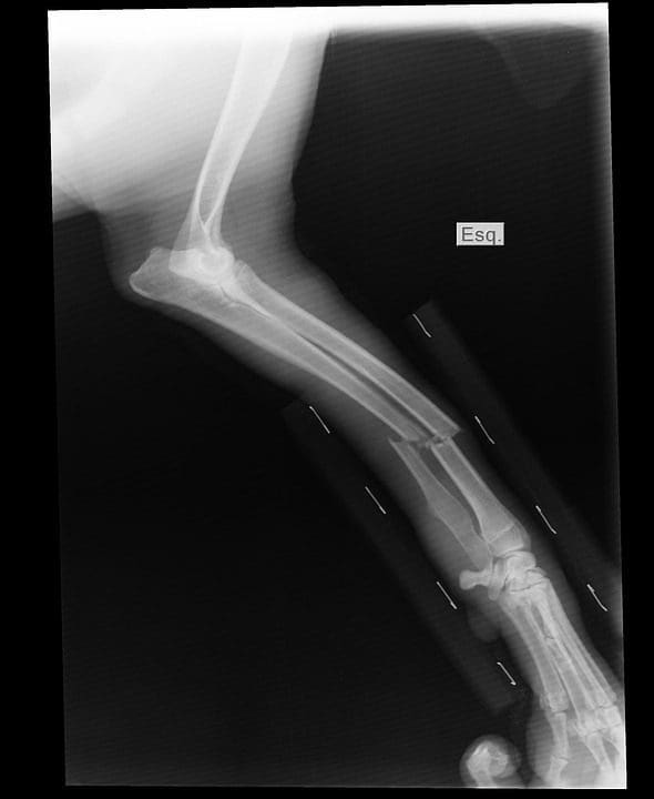 x-ray broken arm el paso tx