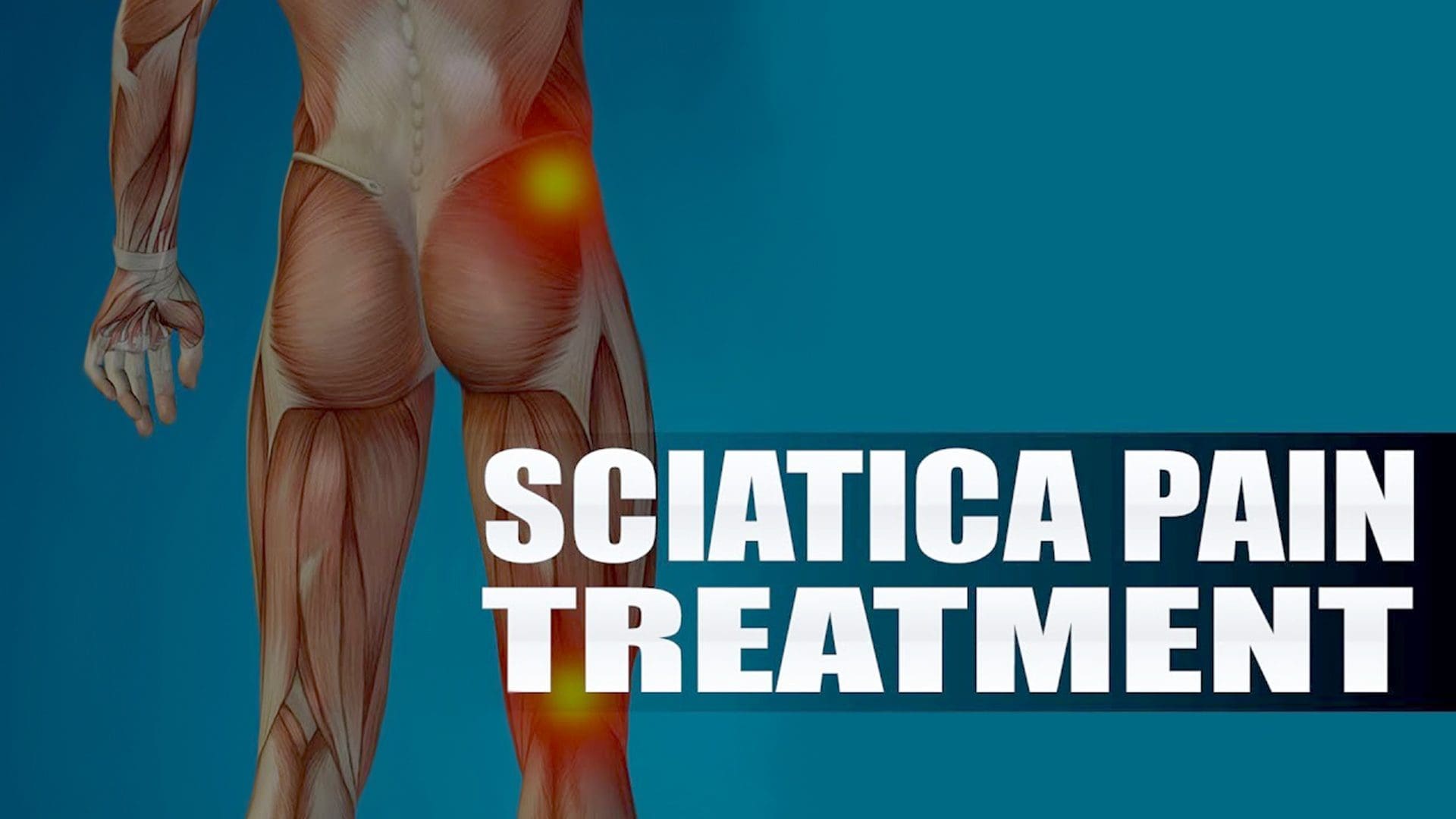 sciatica treatment rehabilitation injury medical chiropractic clinic el paso, tx.