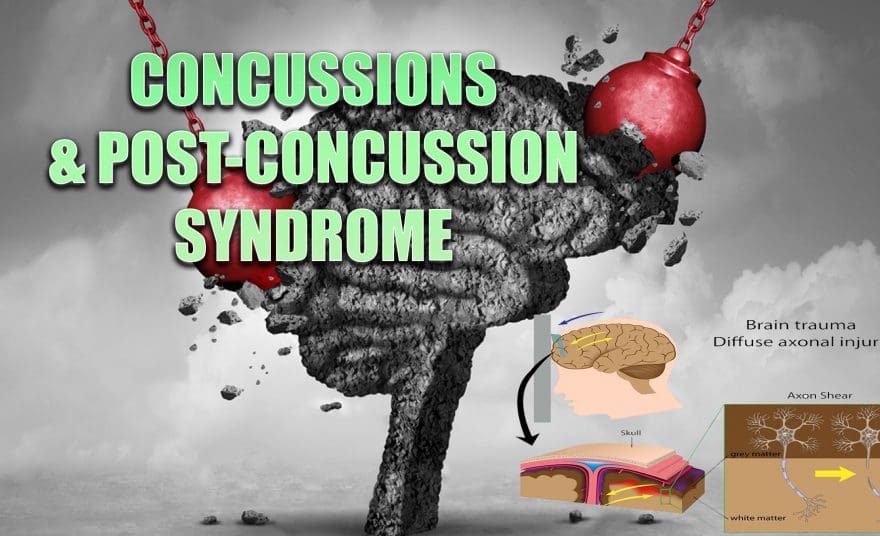 concussions el paso tx.