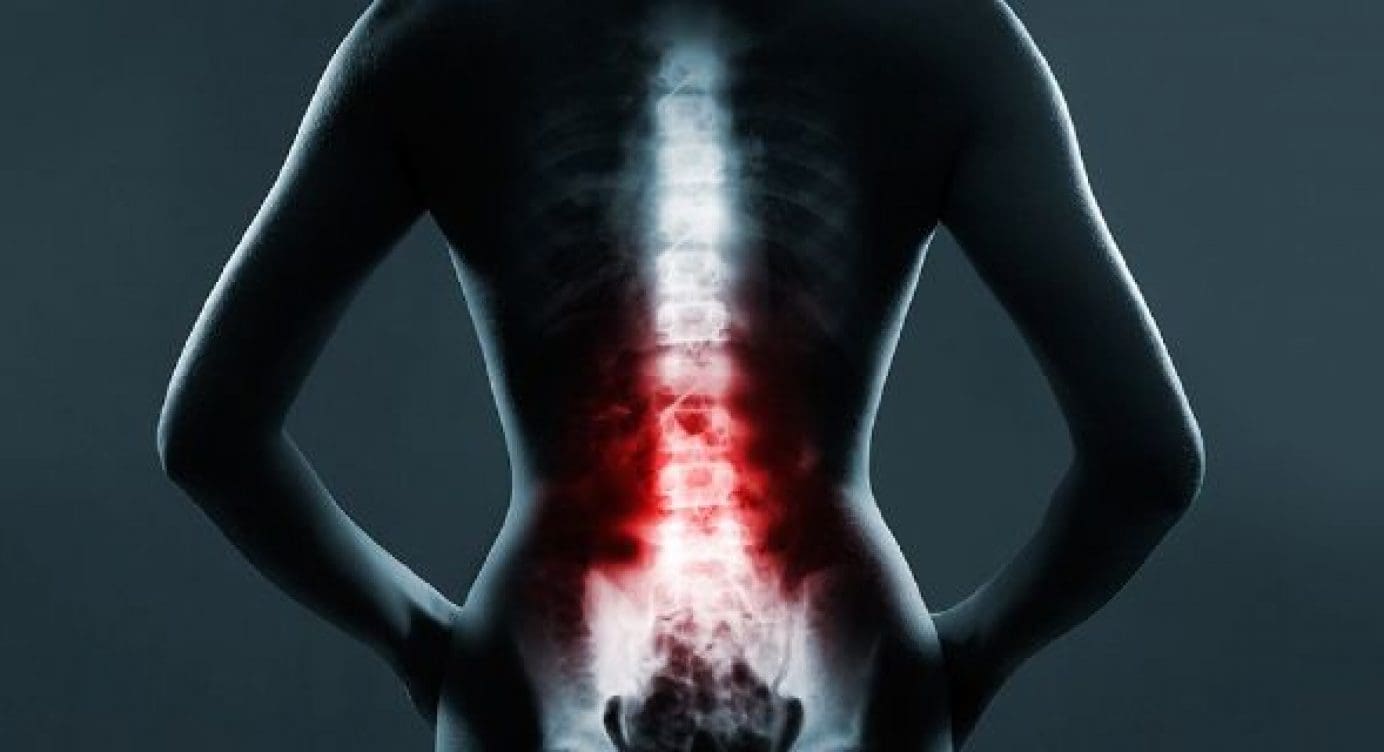 The Role of Emergency Radiology in Spinal Trauma
