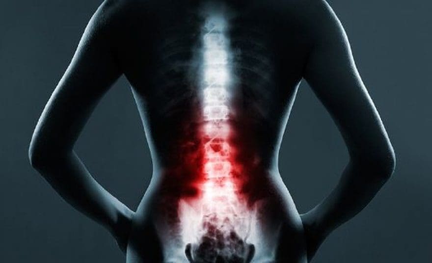The Role of Emergency Radiology in Spinal Trauma | El Paso, TX Chiropractor
