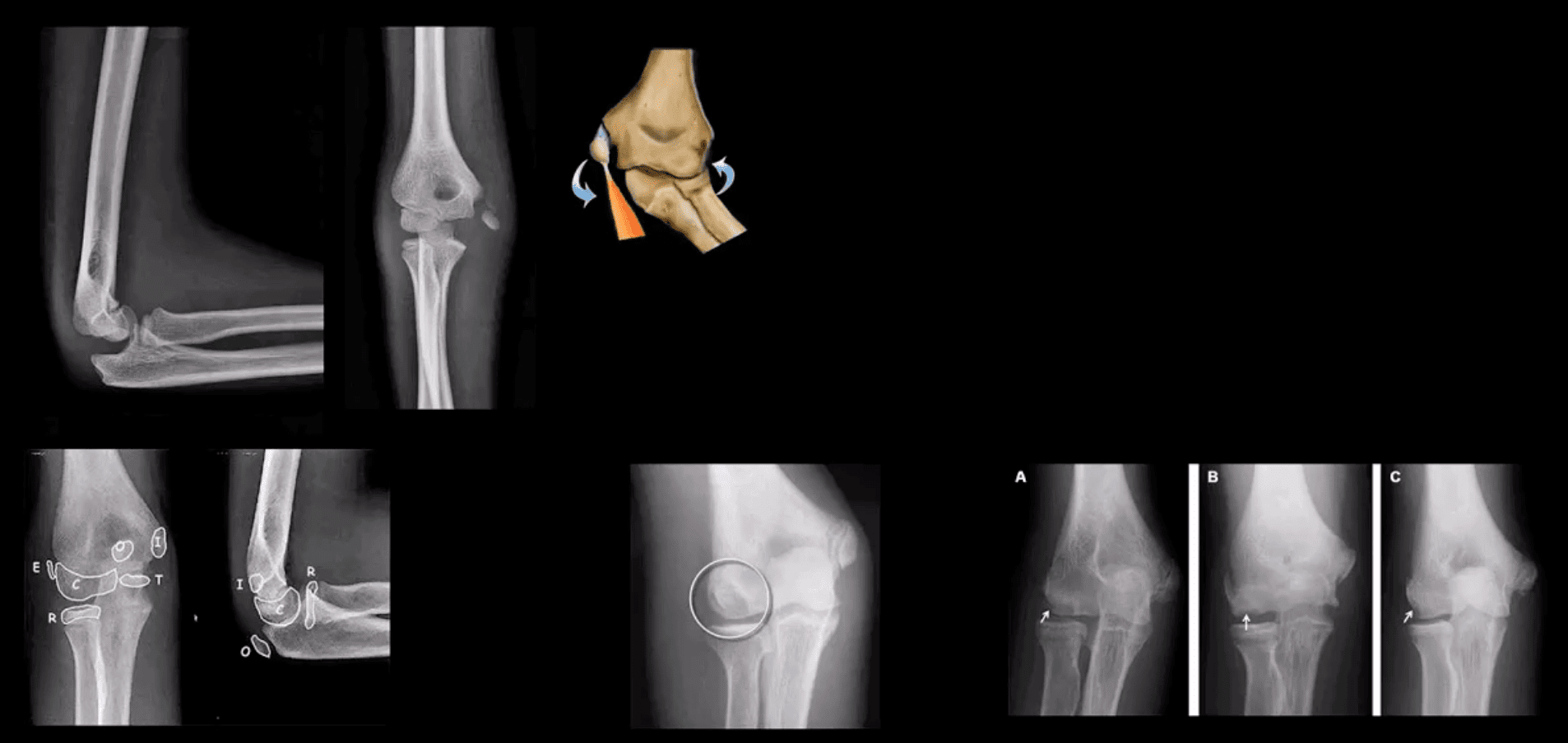 elbow imaging el paso tx.