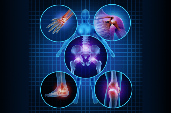 Ultrasound-Guided Orthobiologics for Joint Health Benefits