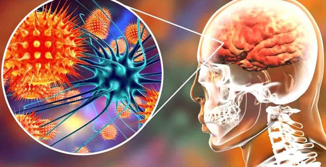 Functional Neurology: Understanding Autoimmune Brain Disease | El Paso, TX Chiropractor