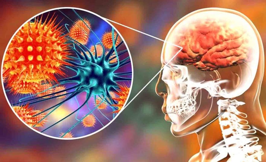 Functional Neurology: Understanding Autoimmune Brain Disease | El Paso, TX Chiropractor