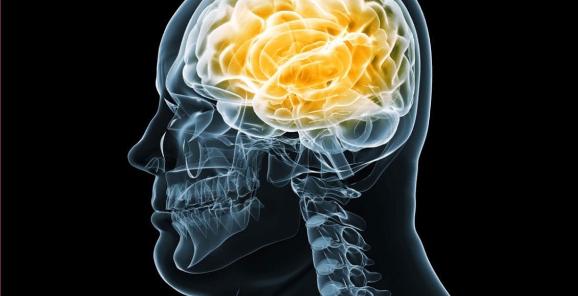 Functional Neurology: Brain Health and Obesity | El Paso, TX Chiropractor