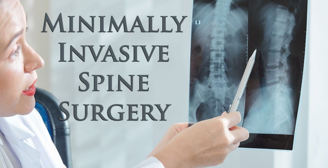 11860 Vista Del Sol, Ste.128 M.I.S.S. Minimally Invasive Spine Surgery