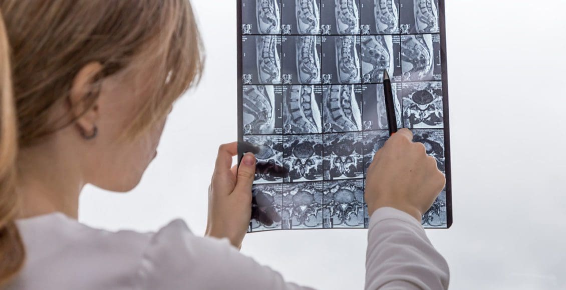 Diarrhea and Back Pain Injury Medical Chiropractic