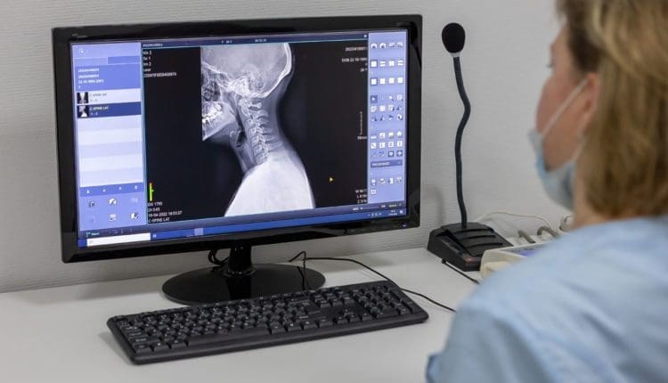 Nurse Practitioner Trauma Management After MVAs