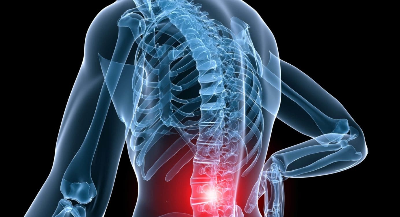 An Overview Of Vertebral Pain Syndrome