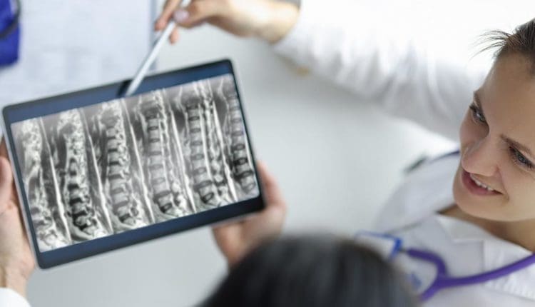 Radiculopathy Integrative Recovery Methods and Benefits