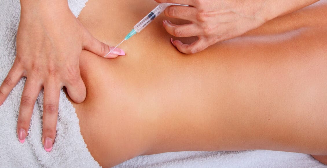 PRP for Sciatica: Innovative Solutions for Pain Relief