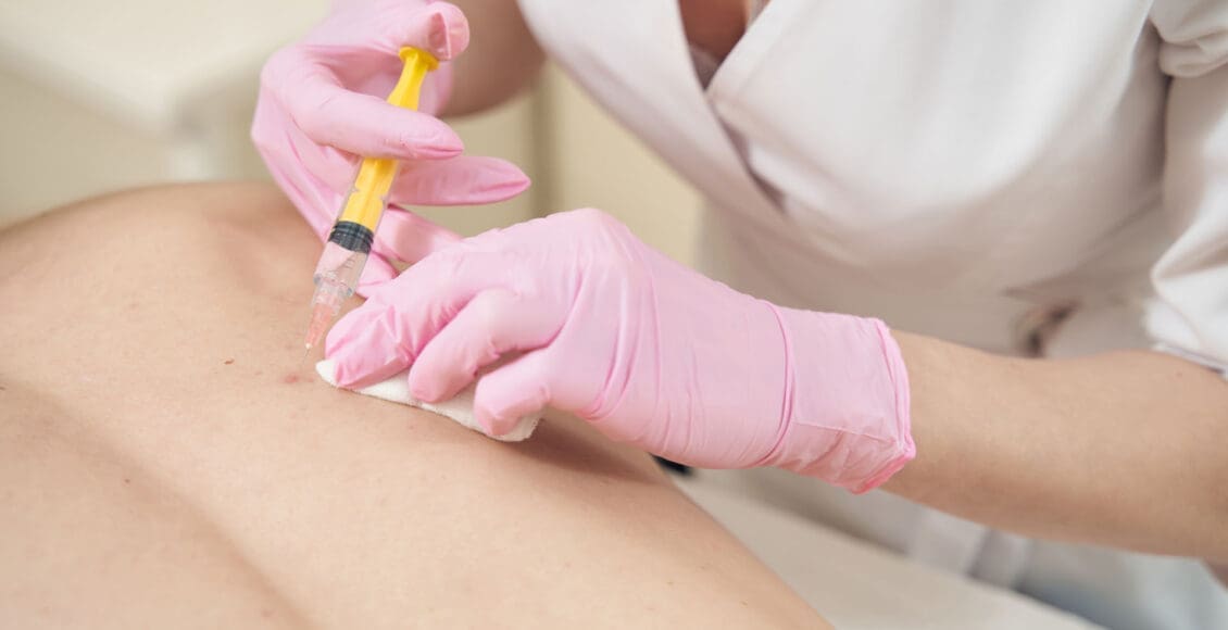 PRP Therapy for Spinal Degeneration Treatment Options