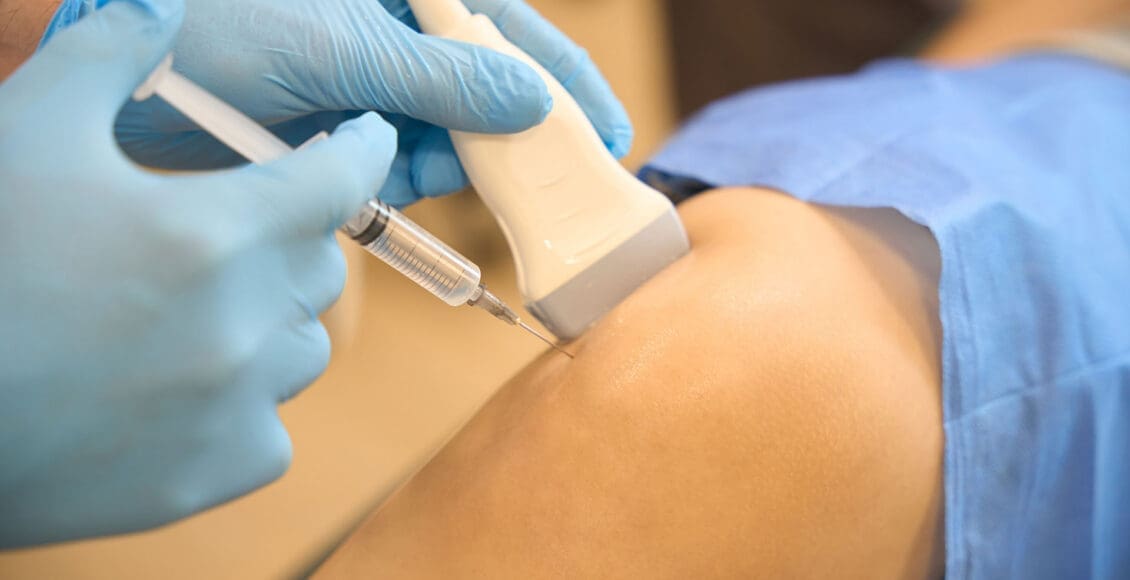 Platelet-Rich Plasma Therapy for Sports Injuries Recovery