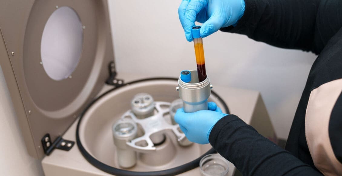Clinical PRP Guide for Musculoskeletal Pain Relief Strategies